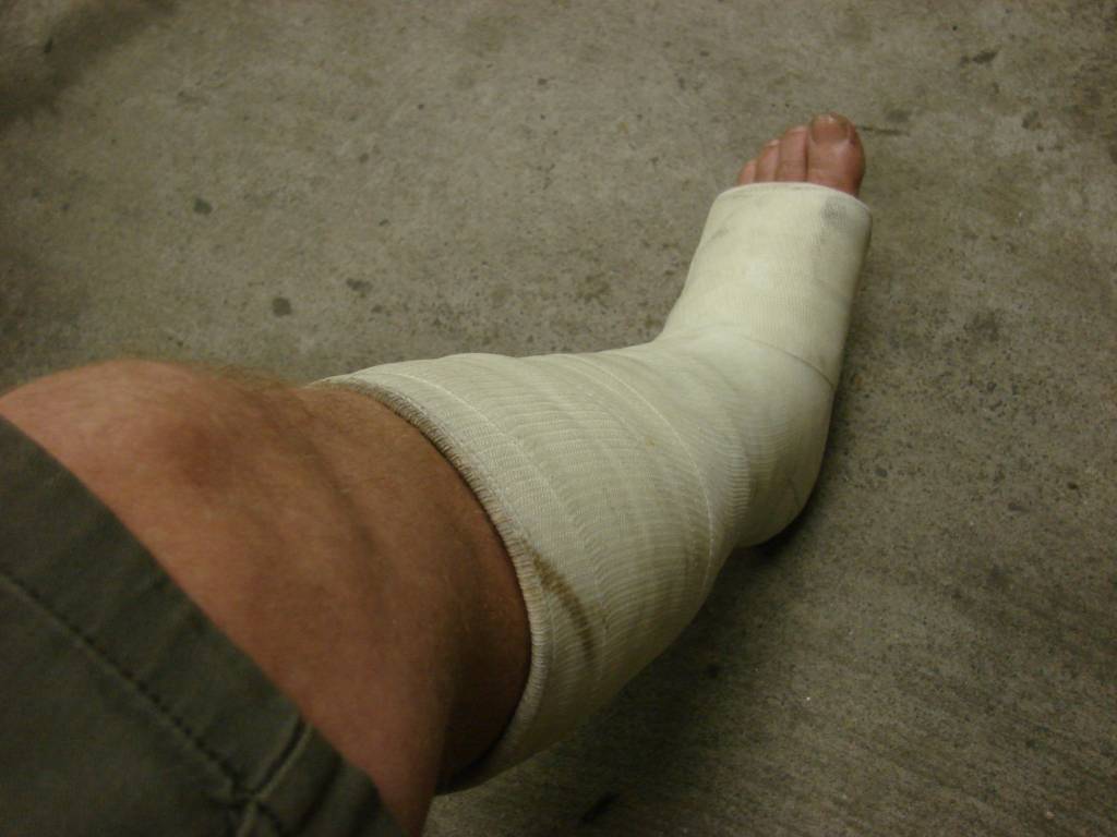 leg.jpg